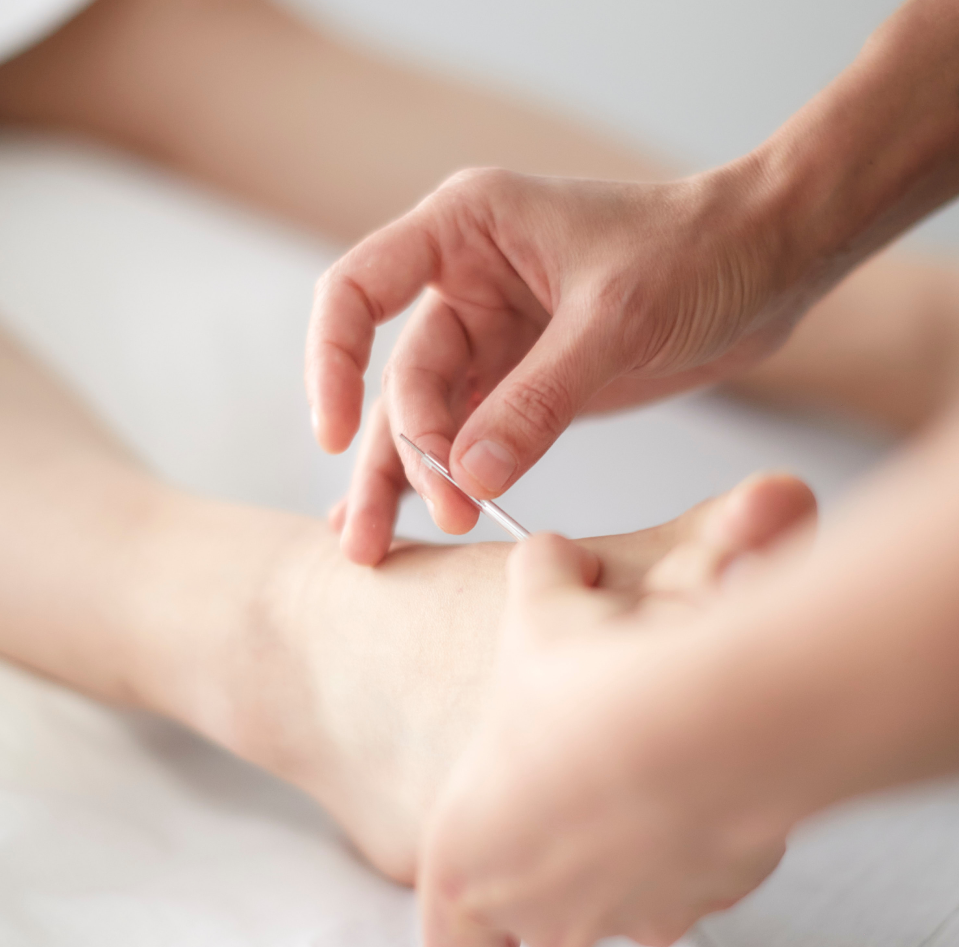 Image of a student practicing acupuncture on a patient's upper foot region.