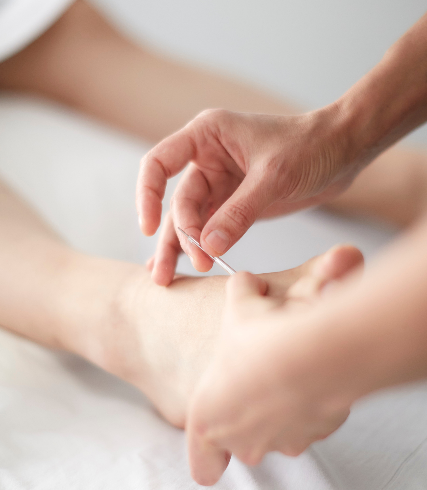 Soft image of a practitioner performing acupuncture on a foot.